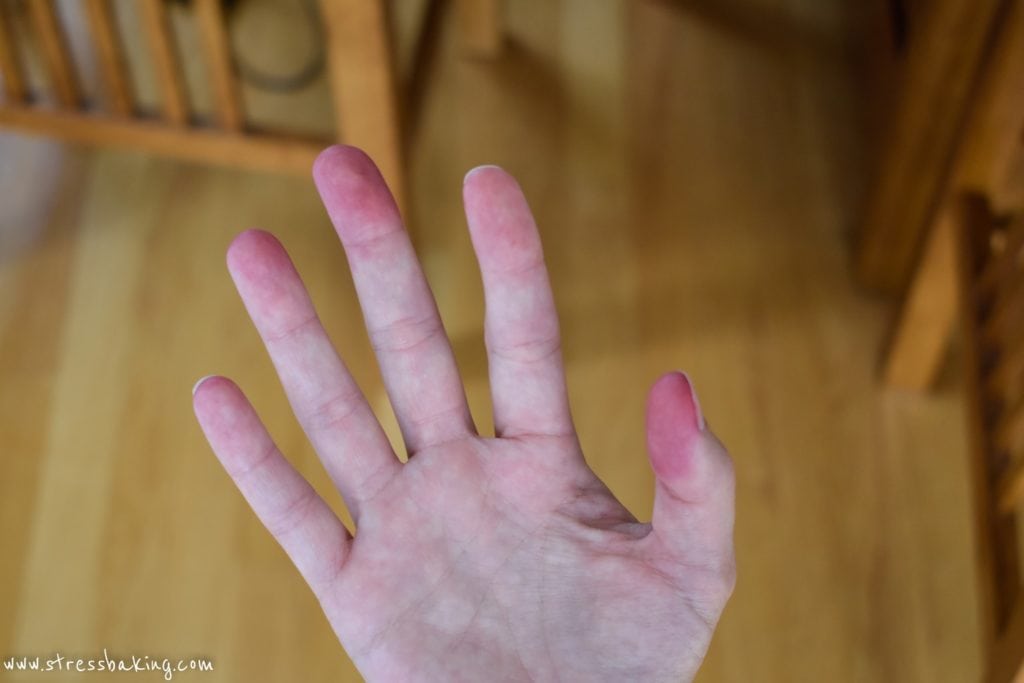 Beet stains on hands